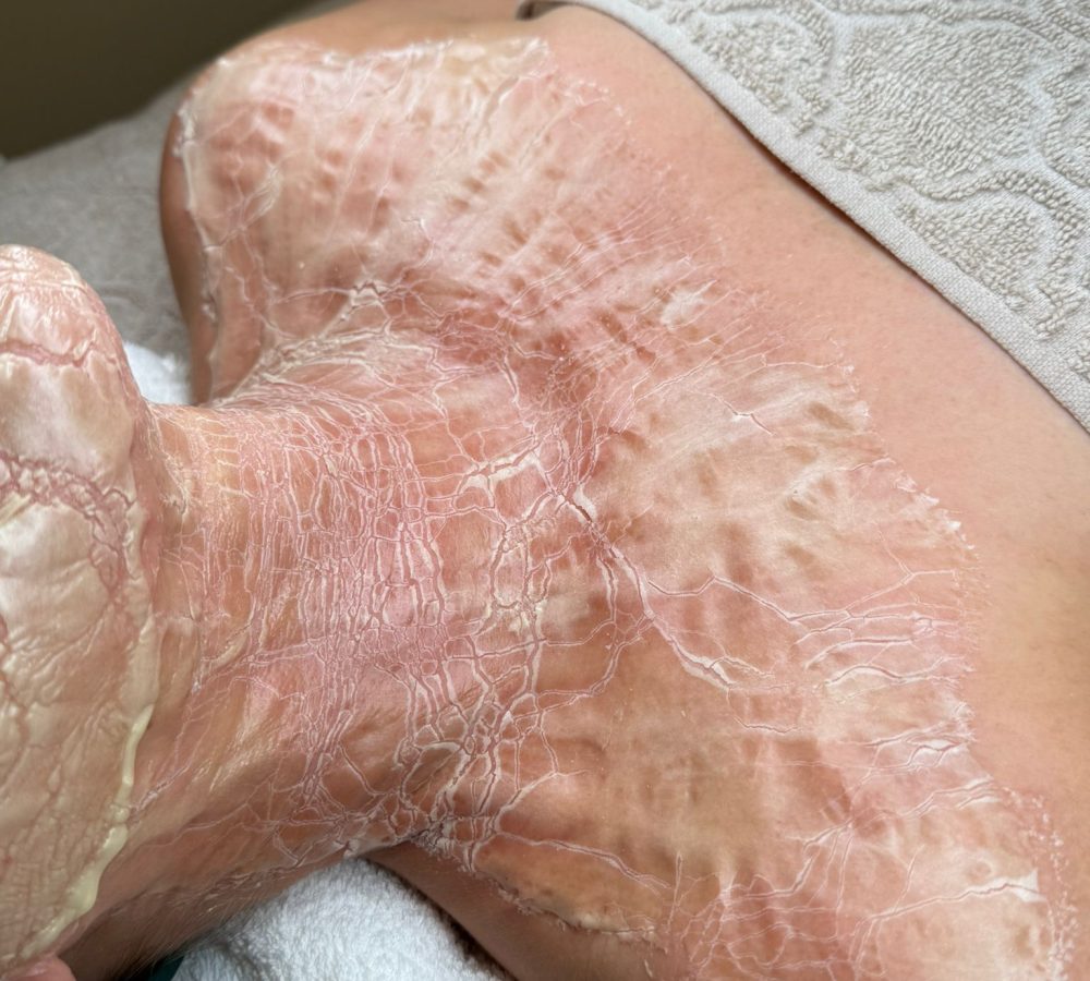 Lauralle DMK hoitoon kuva