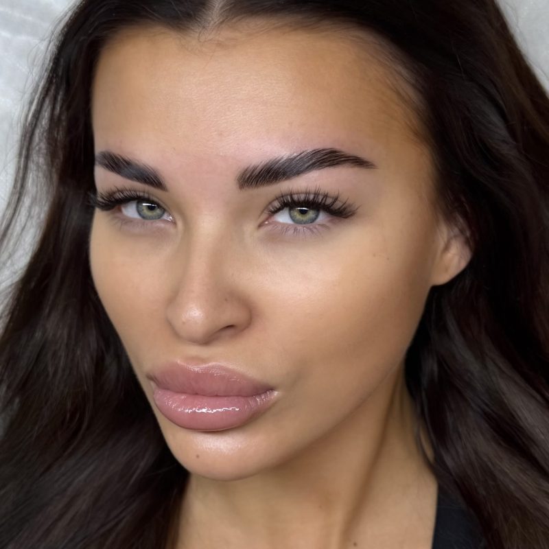 Ripset ja lami kulmat